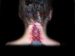 Tattoos - Skin Tear - 30626
